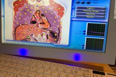 Integrated Energy Therapy – IET®